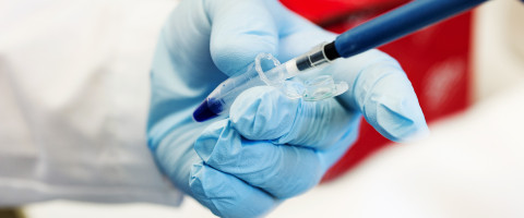 Pipetting.